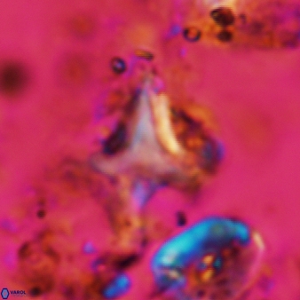Palaeorhomboaster svabenickae 581