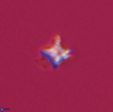 Palaeorhomboaster svabenickae 12561