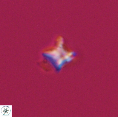 Palaeorhomboaster svabenickae 12561