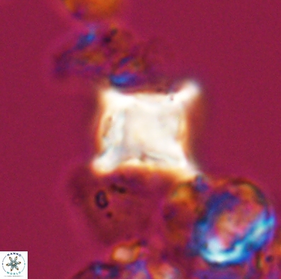 Palaeorhomboaster svabenickae 12587