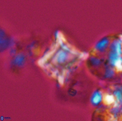 Palaeorhomboaster svabenickae 12589