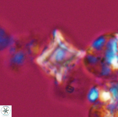 Palaeorhomboaster svabenickae 12589