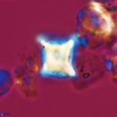 Palaeorhomboaster svabenickae 12591