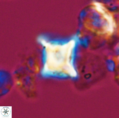 Palaeorhomboaster svabenickae 12591