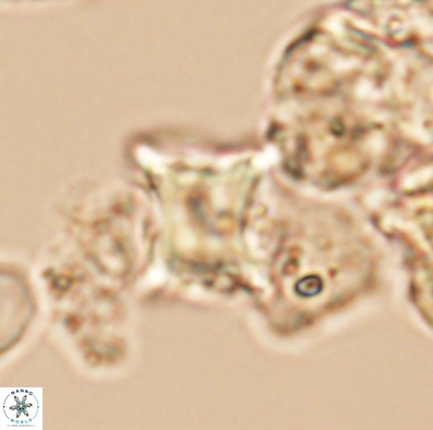 Palaeorhomboaster svabenickae 12592