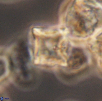 Palaeorhomboaster svabenickae 12593