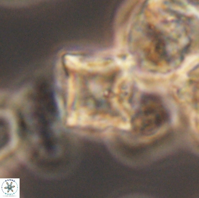 Palaeorhomboaster svabenickae 12593