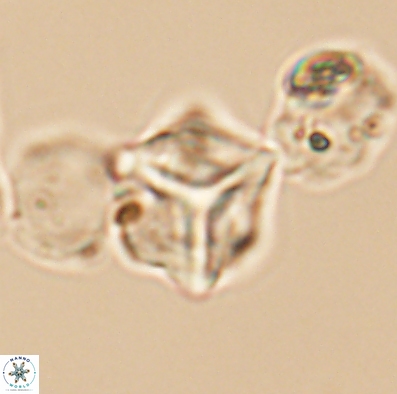 Palaeorhomboaster svabenickae 12594