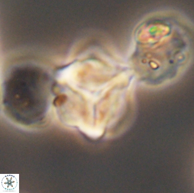 Palaeorhomboaster svabenickae 12595