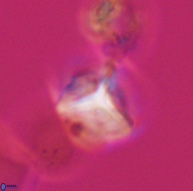 Palaeorhomboaster svabenickae 12598