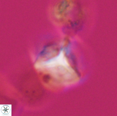 Palaeorhomboaster svabenickae 12598