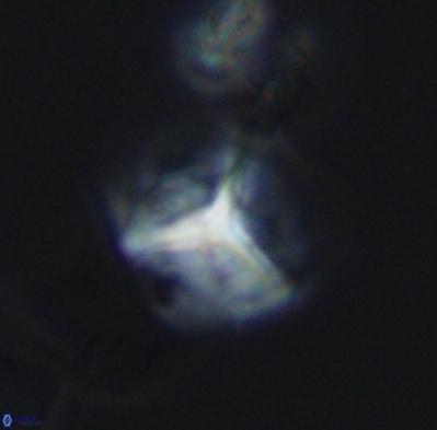 Palaeorhomboaster svabenickae 12599