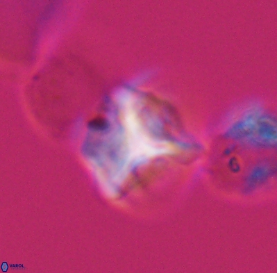 Palaeorhomboaster svabenickae 12601