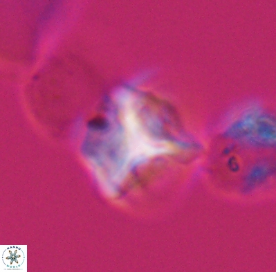Palaeorhomboaster svabenickae 12601