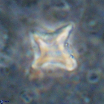 Palaeorhomboaster svabenickae 14828