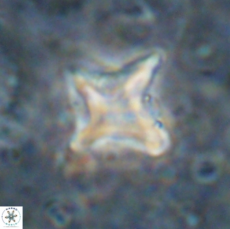 Palaeorhomboaster svabenickae 14828