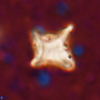 Palaeorhomboaster svabenickae 14831