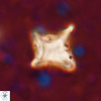 Palaeorhomboaster svabenickae 14831
