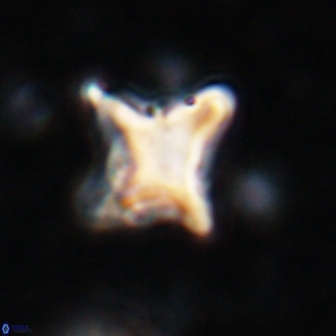 Palaeorhomboaster svabenickae 14835