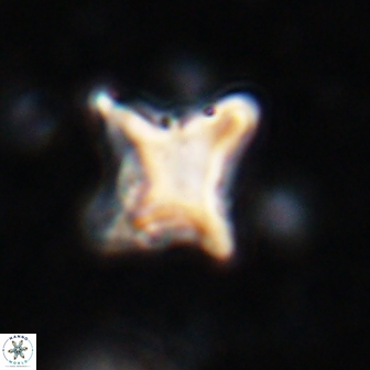 Palaeorhomboaster svabenickae 14835