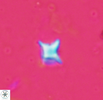 Palaeorhomboaster svabenickae 1830