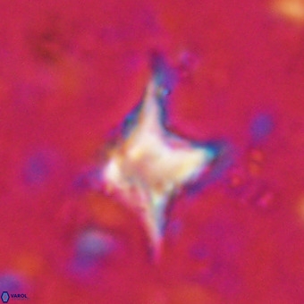 Palaeorhomboaster svabenickae 21257