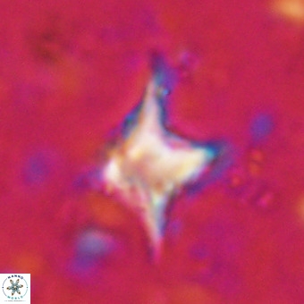 Palaeorhomboaster svabenickae 21257