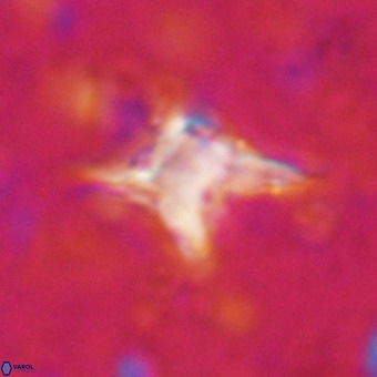 Palaeorhomboaster svabenickae 21261
