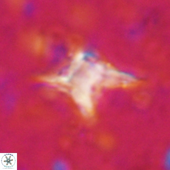 Palaeorhomboaster svabenickae 21261