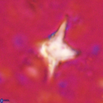 Palaeorhomboaster svabenickae 21264