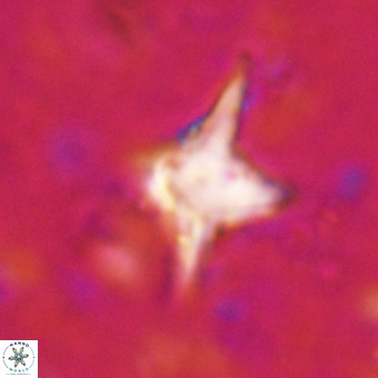Palaeorhomboaster svabenickae 21264