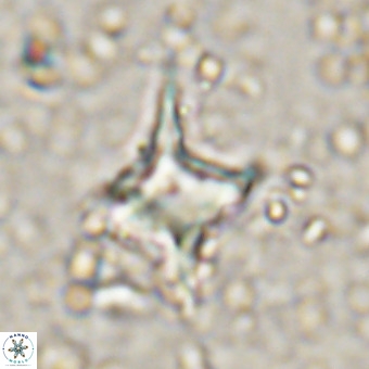 Palaeorhomboaster svabenickae 21267