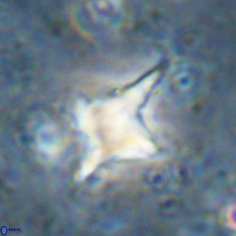 Palaeorhomboaster svabenickae 21271
