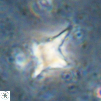 Palaeorhomboaster svabenickae 21271