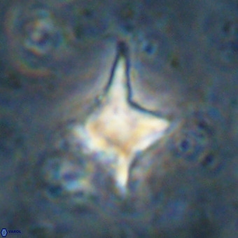 Palaeorhomboaster svabenickae 21272