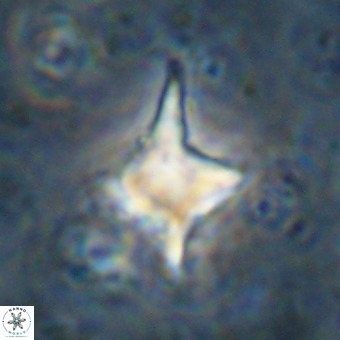 Palaeorhomboaster svabenickae 21272
