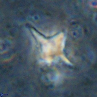 Palaeorhomboaster svabenickae 21274