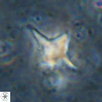 Palaeorhomboaster svabenickae 21274
