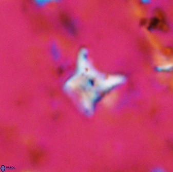 Palaeorhomboaster svabenickae 33816