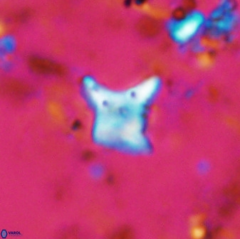 Palaeorhomboaster svabenickae 33817