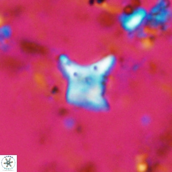 Palaeorhomboaster svabenickae 33817