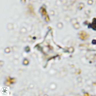 Palaeorhomboaster svabenickae 33821