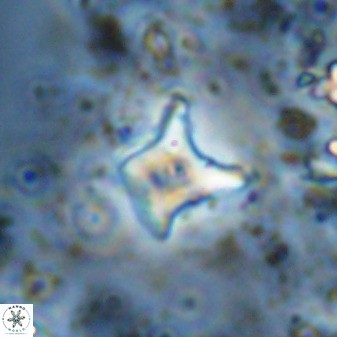 Palaeorhomboaster svabenickae 33822
