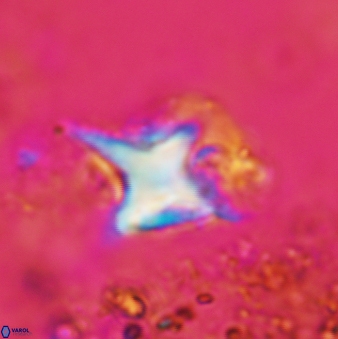 Palaeorhomboaster svabenickae VR 00903