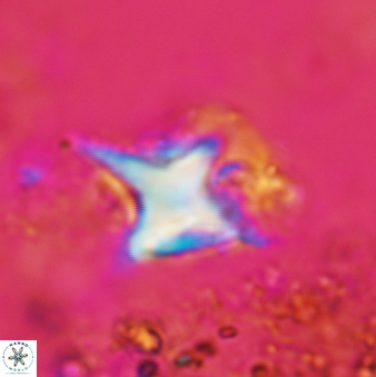 Palaeorhomboaster svabenickae VR 00903