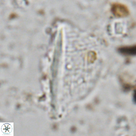 Pennalithus extensus VR 06429