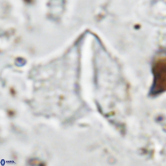 Pennalithus finifer VR 06626