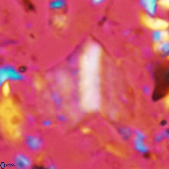 Pennalithus finifer VR 06633