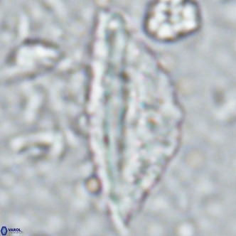 Pennalithus rugosus VR 16445