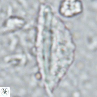 Pennalithus rugosus VR 16445